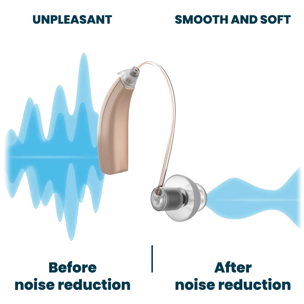 Advanced Noise Reduction