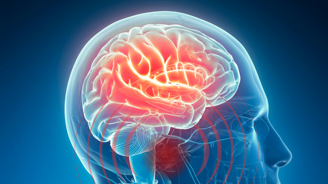 An illustration showing a brain with sound waves emanating from it, representing neurological tinnitus and the brain's response to phantom sounds.