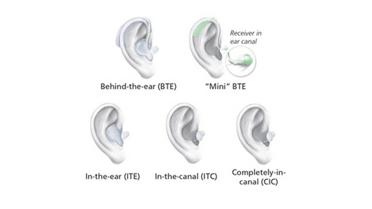 An image showing different types of hearing aids, including Invisible-in-Canal (IIC), Behind-the-Ear (BTE), Receiver-in-Canal (RIC), In-the-Ear (ITE), and Completely-in-Canal (CIC) devices.