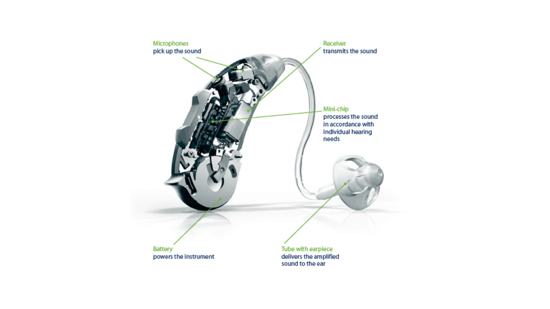 Illustration depicting the components and functionality of a modern hearing aid.